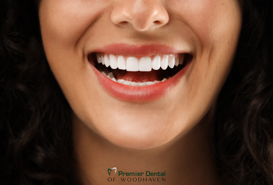 a close up of a woman 's mouth with the words premier dental of woodhaven on the bottom